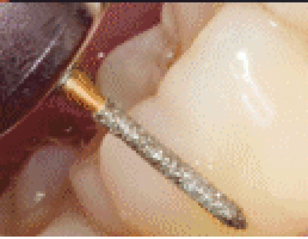 Goldene Diamantschleifer (Tiger)